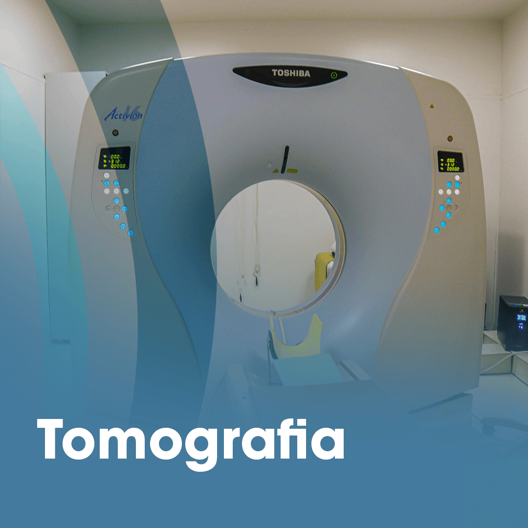Tomografia Computadorizada